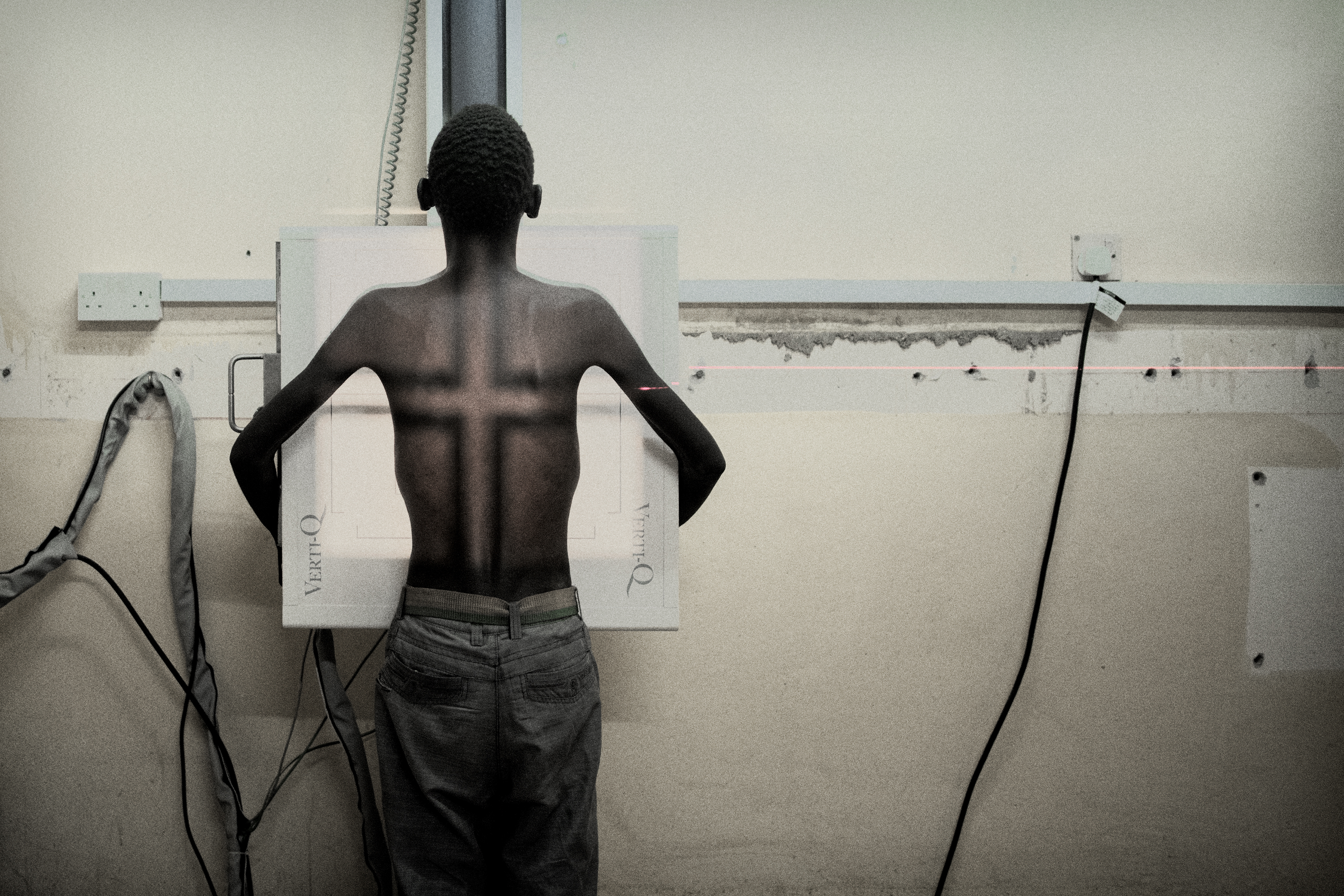 Simbazako, 19 ans, passe une radiographie de dépistage de la tuberculose à l’hôpital de district de Nsanje. MSF contribue à y améliorer le diagnostic et la prise en charge clinique du VIH et de la TB. © Luca Sola, juin 2017